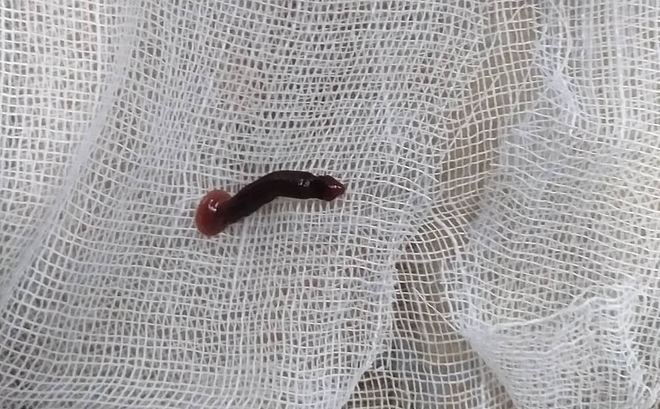 Hình ảnh con đỉa