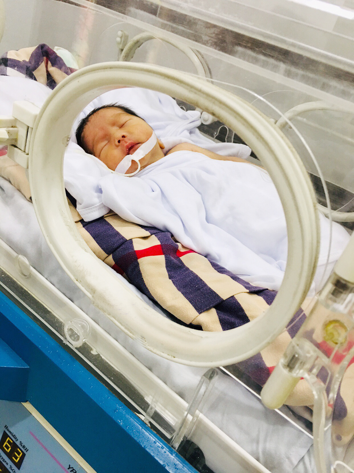 Bé được điều trị trong lồng ấp