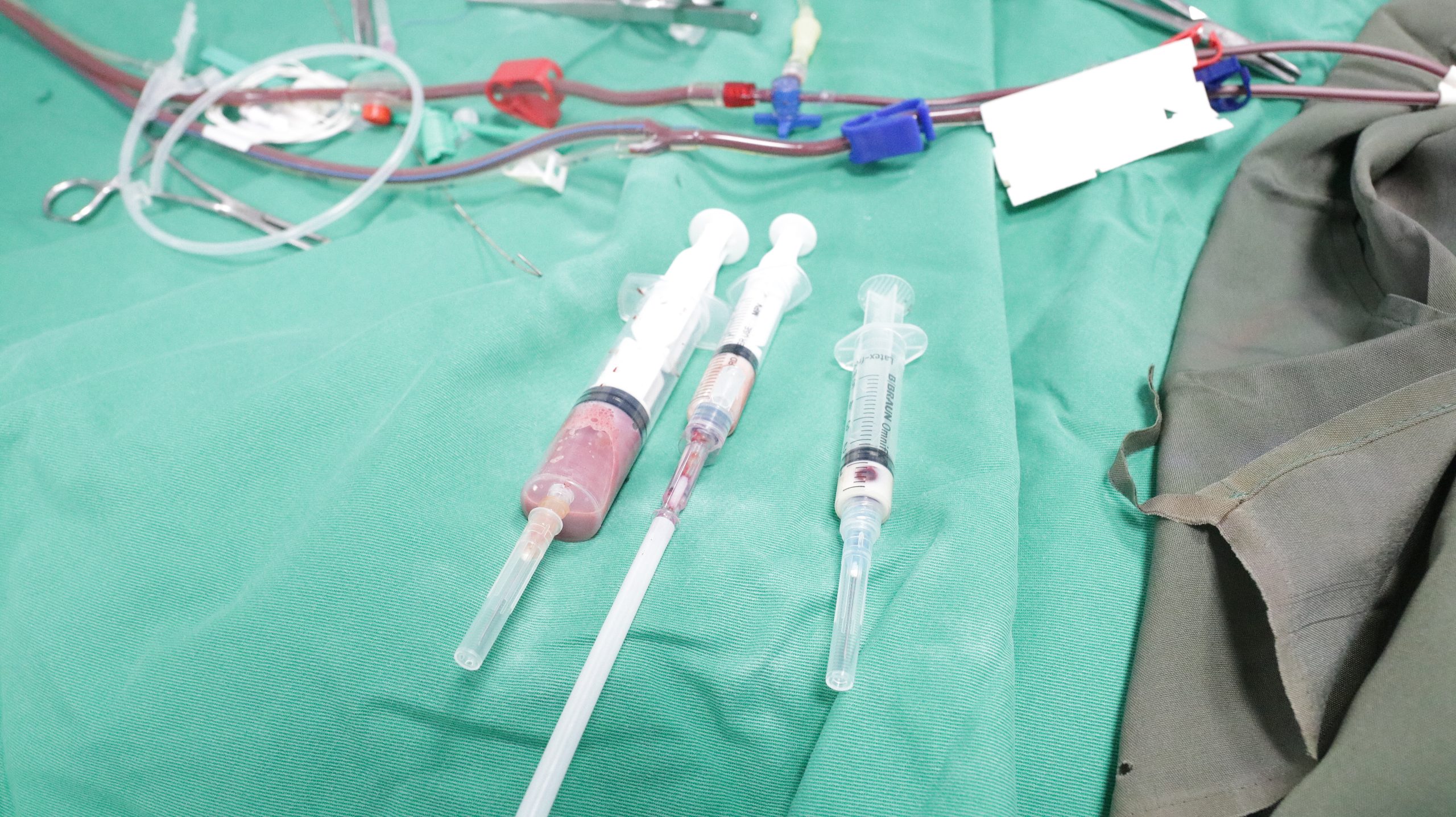 Máu của người bệnh trước khi được lọc máu cấp cứu(hình ảnh mỡ máu trắng đục)